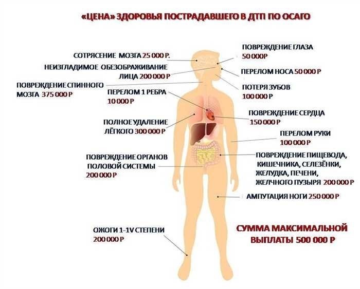 Компенсация вреда здоровью по ОСАГО после ДТП