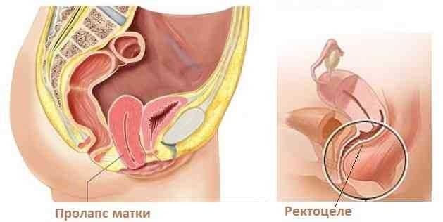 Что значит опущенное определение, признаки и последствия